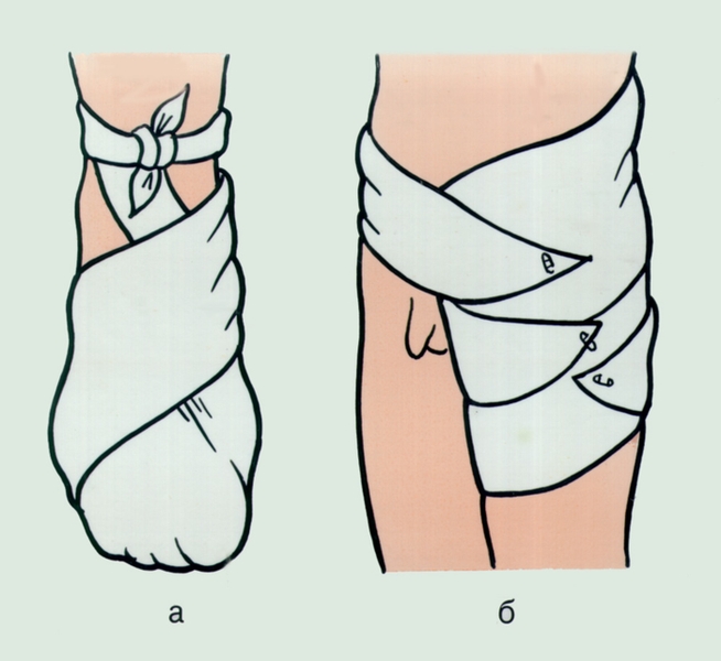 Рис. 3. Использование треугольной косынки для наложения повязок на стопу (а) и <a href=