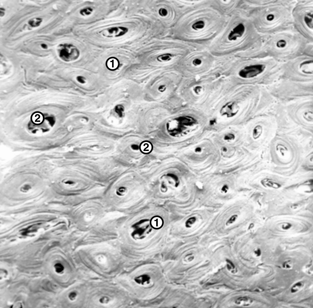 Рис. 3. Фрагмент компактной кости: 1 — остеоны на поперечном срезе; 2 — центральные каналы. Между остеонами видны полуцилиндрические пластинчатые комплексы. Сканирующая электронограмма; ×50