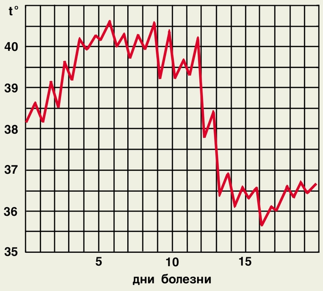 Рис. 2а). Температурные кривые при различных типах лихорадки — постоянная