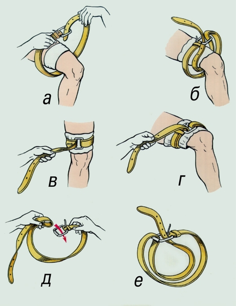 Рис. 3. Использование поясного ремня в качестве кровоостанавливающего жгута: а, б, в, г — этапы наложения жгута; д, е — подготовка двойной петли