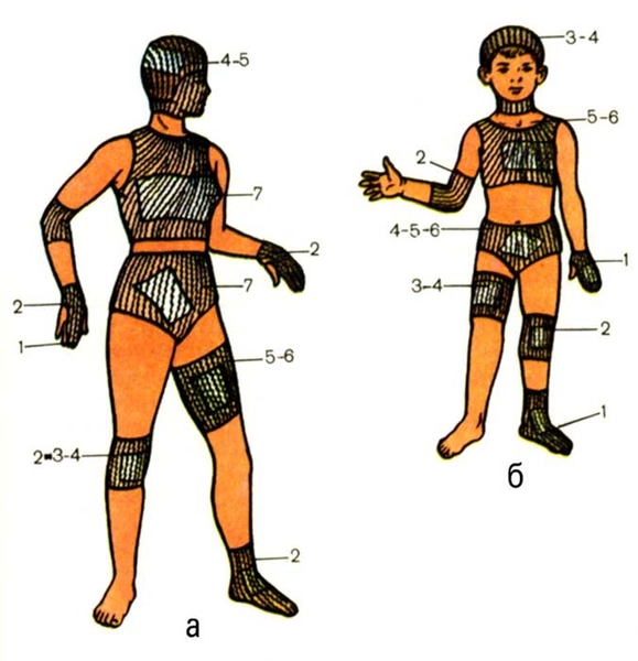 Рис. 6. Места наложения сетчатых повязок у взрослых (а) и детей (б). Цифрами указаны номера сетчатых бинтов