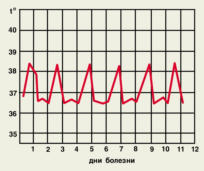 Рис. 5б).Температурная кривая при тропической малярии у коренных жителей эндемичных районов (перемежающаяся лихорадка)