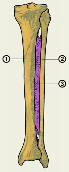 Рис. 1. Кости правой голени и межкостная перепонка: 1 — большеберцовая кость; 2 — малоберцовая кость; 3 — межкостная перепонка