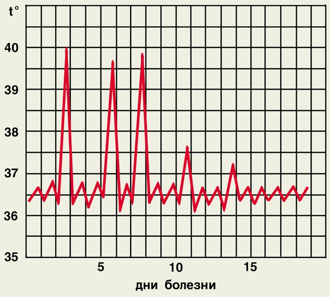 Рис. 2в). Температурные кривые при различных типах лихорадки — интермиттирующая