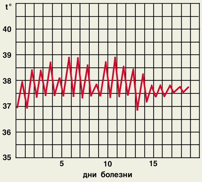 Рис. 2б). Температурные кривые при различных типах лихорадки — ремиттирующая