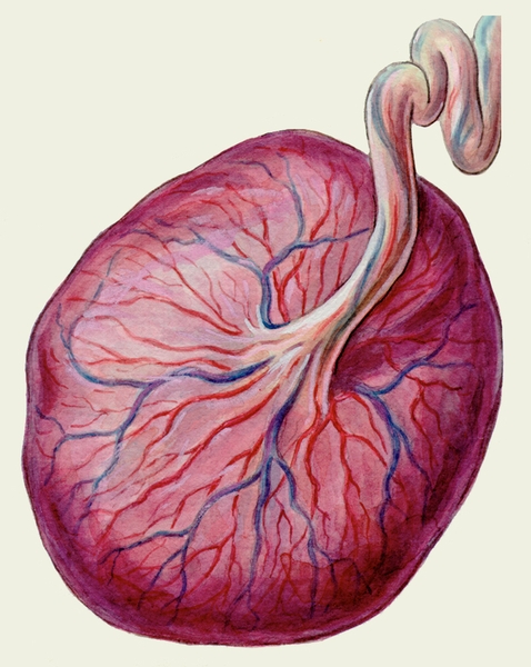 Рис. 1б). Зрелая плацента: плодовая поверхность с отходящей от нее пуповиной