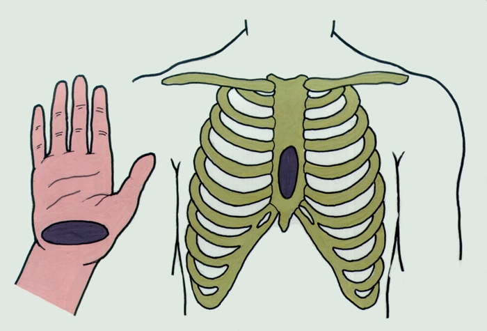 Рис. 1. Место соприкосновения руки и грудины при непрямом массаже сердца