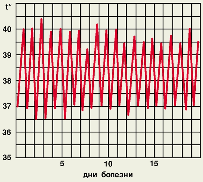 Рис. 2е). Температурные кривые при различных типах лихорадки — гектическая