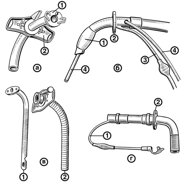 Рис. 1. Основные модели трахеостомических канюль: а — металлическая канюля Люэра (1 — внутренняя трубка, 2 — подвижной щиток); б — каучуковая канюля (1 — надувная <a href=