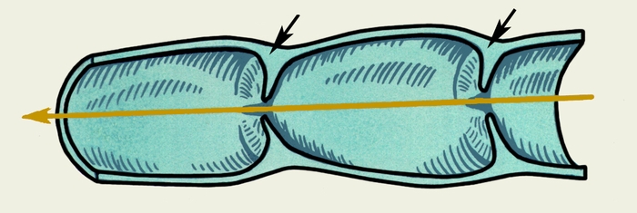 Рис. 3. Схематическое изображение лимфатического сосуда, имеющего четкообразный вид (продольный <a href=