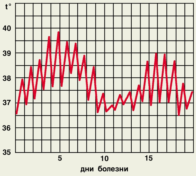 Рис. 2д). Температурные кривые при различных типах лихорадки — волнообразная